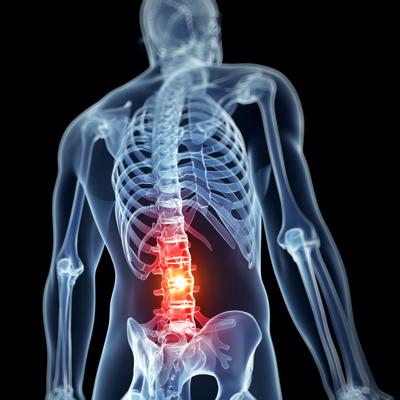 An x-ray of a back with an injury highlighted in red.