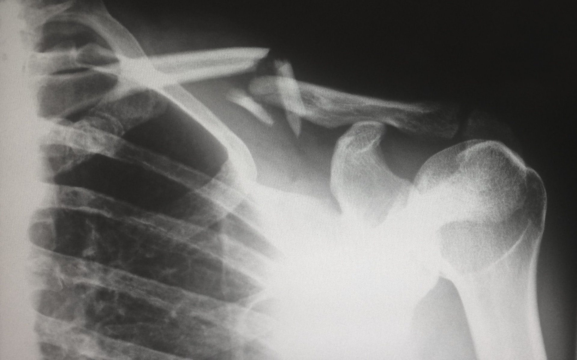 Nueva York catastrophic injury lawyer
